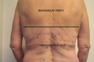 Före och efter i samma bild